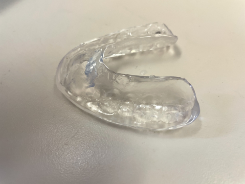 A typical occlusal splint to be worn by the patient at night as a conservative treatment option for temporomandibular disorders.
 